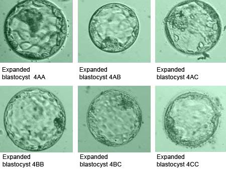 ivf centre in Meerut