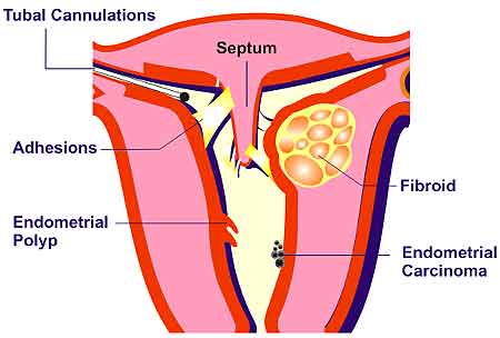 Laproscopy Surgeon in Meerut