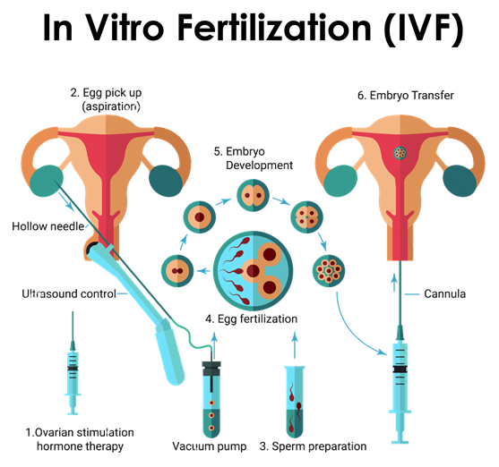 ivf centre in Meerut