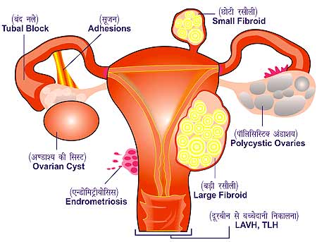 Laproscopy Surgeon in Meerut